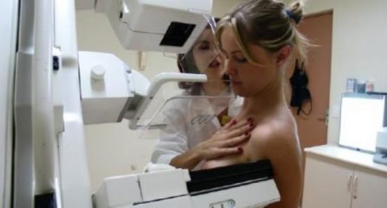 mamografia-outubro-rosa-cancer-mama-prevencao